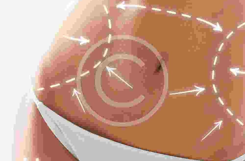 The fuller look breast augmentation