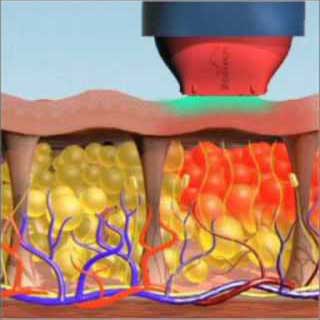 Customized Skin Care Treatments Glendora