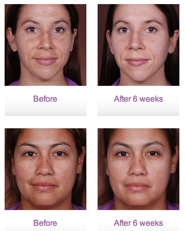 Obagi Medical Products Glendora