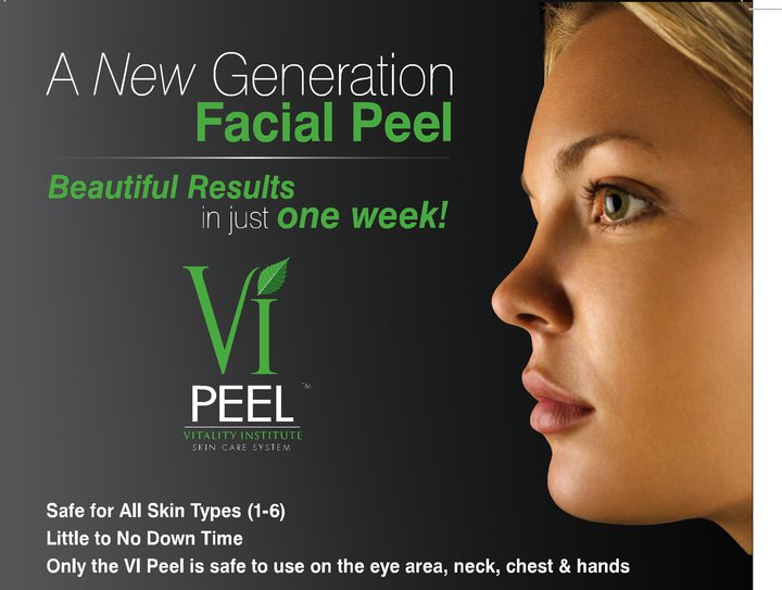 VI Peel Glendora