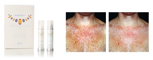 Elast derm Glendora