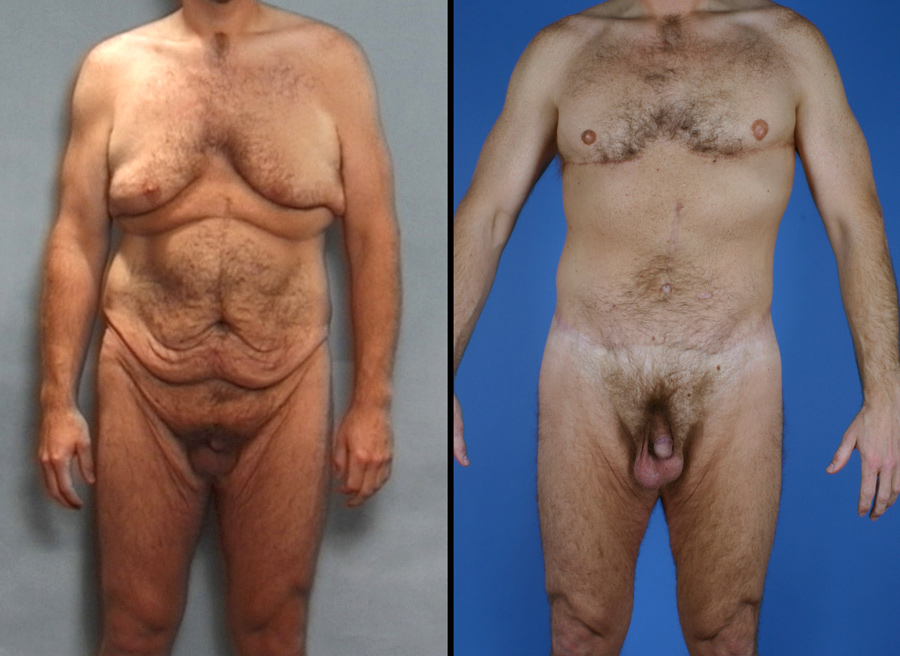 Male Procedures Glendora