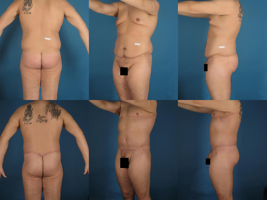 Male Procedures Glendora