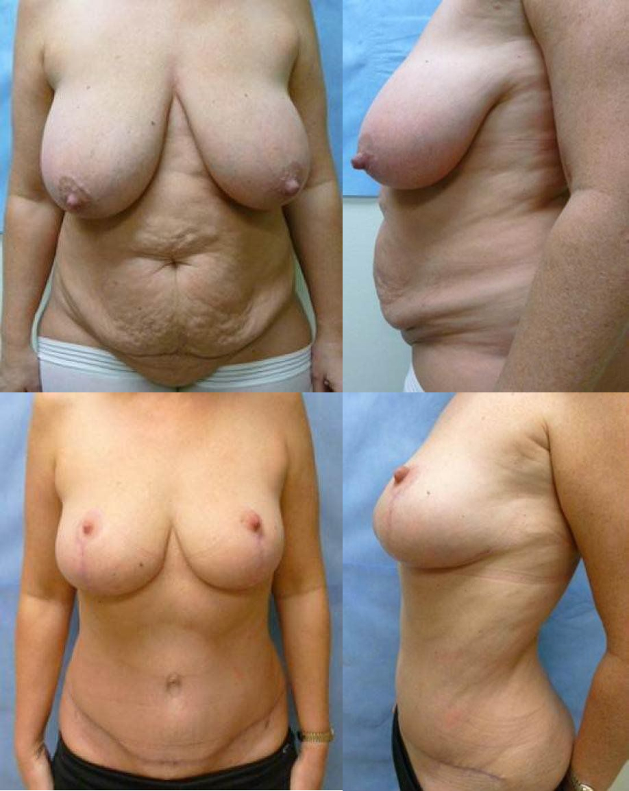 Weight Loss Treatment Glendora